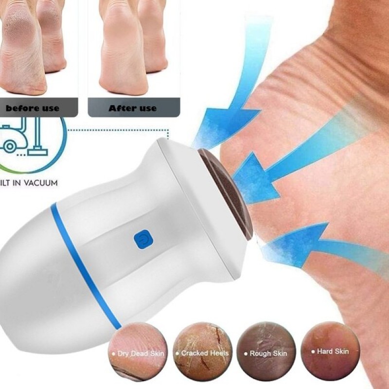 Buy feet callus remover at best price in Pakistan | Just Buy It